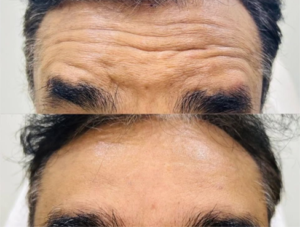 istockphoto-1271005709-612x612 1