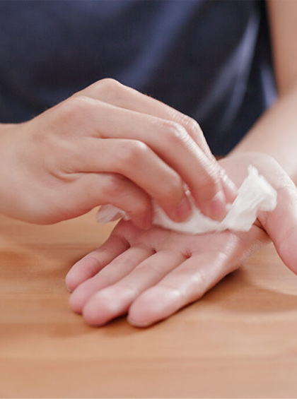 Hyperhidrosis Treatment